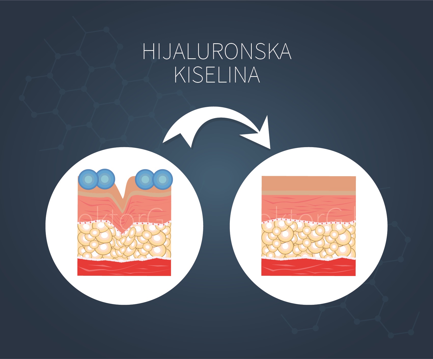 Hijaluronska-kiselina-prikaz2