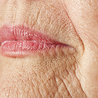 wrinkless